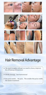 Semua dalam satu Picosecond Laser Hair Removal dan ND YAG Laser Tattoo Removal Machine
