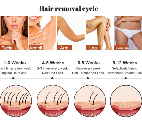 Trio 3 panjang gelombang Diodo Laser 755/808/1064nm untuk Alexandrite Ice Laser Hair Removal