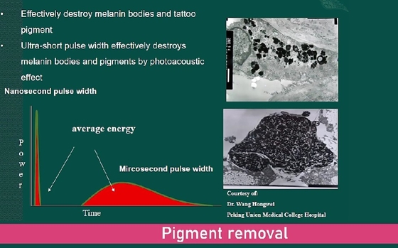 Mesin Laser YAG Picosecond Komersial 3500W Alat Penghapusan Tato Laser Tanpa Nyeri