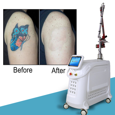 Mesin Laser Picosecond Gaya Stasioner 2000W Q Switched Nd YAG Laser Mesin Penghapusan Tato