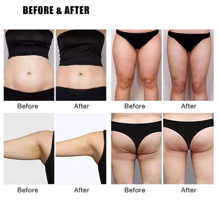 Berat Badan Rendah EMS Slim Machine 4000W Elektromagnetic Body Slimming EMS Mesin Patung