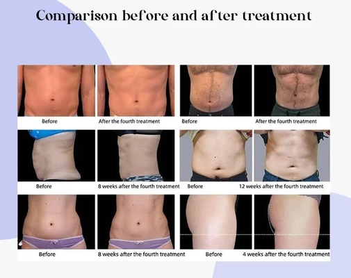 600w 5 Pegang EMS Mesin Patung Untuk Neo RF 14 Tesla Bodi Sculpting Body Slimming