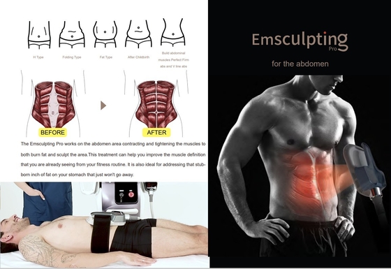 Komersial EMS Slimming Machine 10 inci layar sentuh untuk salon kecantikan / spa
