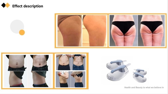 ABS EMS Mesin Body Sculpting Commercial Electric EMS Stimulator Otot