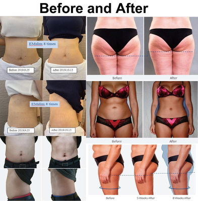 Airproof EMS Slimming Machine 5000W Neo RF EMS Stimulator Pembangunan Otot