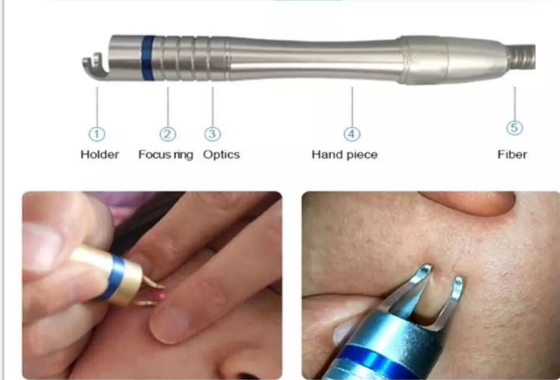 Peremajaan Kulit Mesin Laser Dioda 980nm Mesin Penghapusan Vein Laba-laba Laser Portable