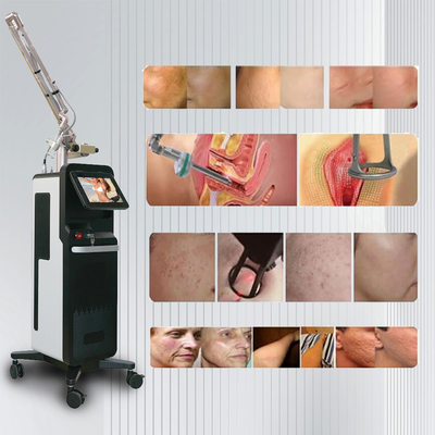 Carbon Dioxide Laser Fractional CO2 Machine Untuk Mencerahkan Kulit Dan Mengencangkan