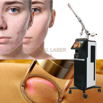 Carbon Dioxide Laser Fractional CO2 Machine Untuk Mencerahkan Kulit Dan Mengencangkan