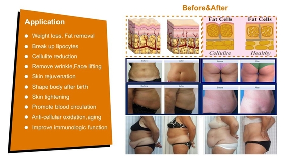 Komersial Cavitation RF Vacuum Slimming Machine 7 in 1 Untuk Pusat Kecantikan