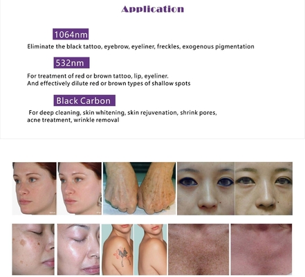 Multifunctional OPT IPL RF ND YAG Laser Machine Penghapusan Rambut Dengan Layar Sentuh 15 Inci