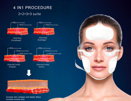 Vertical Magnetic Facial Ems rf Skin Rejuvenation Lifting Skin Tightening Slimming Rf Lifting Mesin untuk mencuci kulit